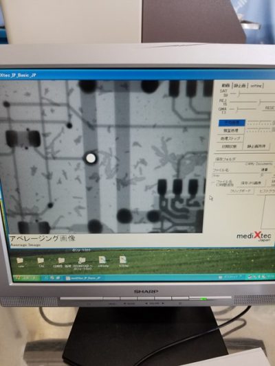 X線透視装置 MX-60BASIC 写真9